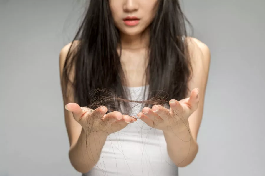 Hair transplant in china. Credit: 招商信诺
